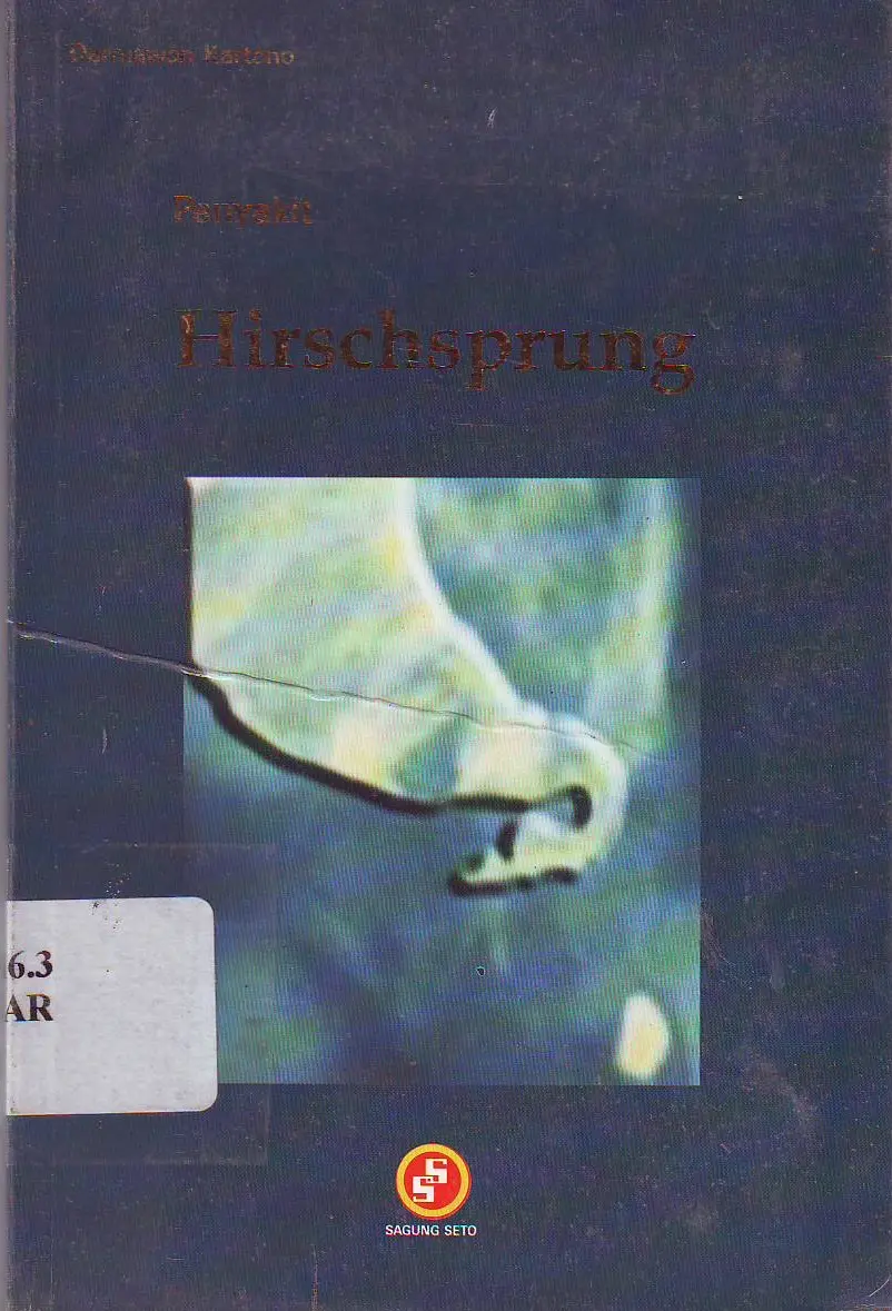 Penyakit Hirschsprung