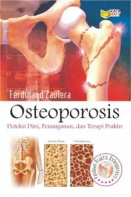 Osteoporosis: Deteksi Dini, Penanganan, dan Terapi Praktis