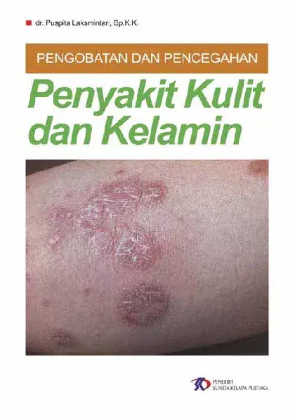 Pengobatan Dan Pencegahan Penyakit Kulit dan Kelamin