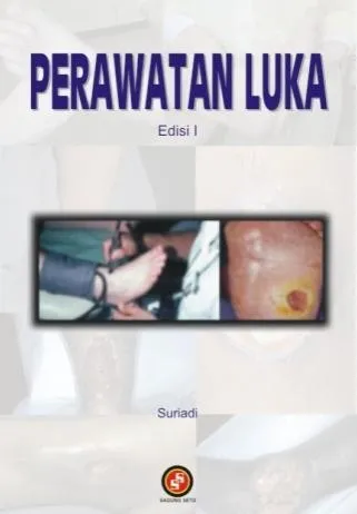 Perawatan Luka